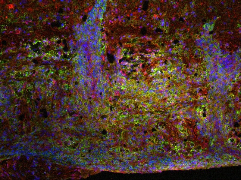 Microscopische foto van ruggenmergweefsel van een muis