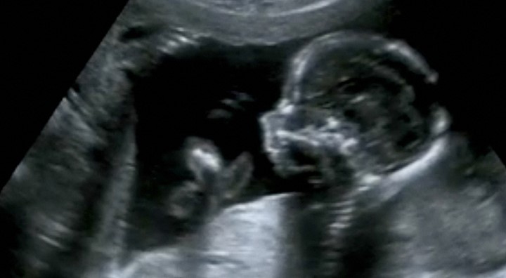 Foetus Onderzoek Roetdeeltjes Tim Nawrot