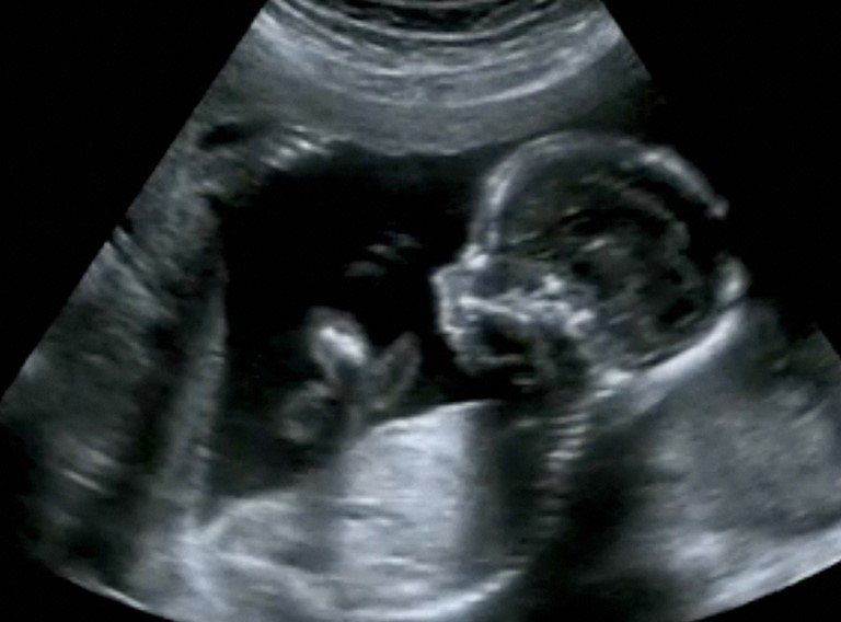 Foetus Onderzoek Roetdeeltjes Tim Nawrot