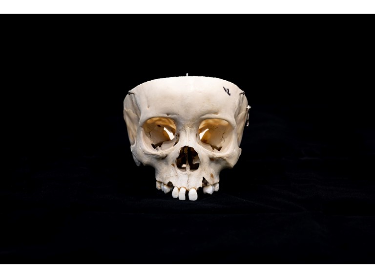 Osteologiemateriaal Schedel 03