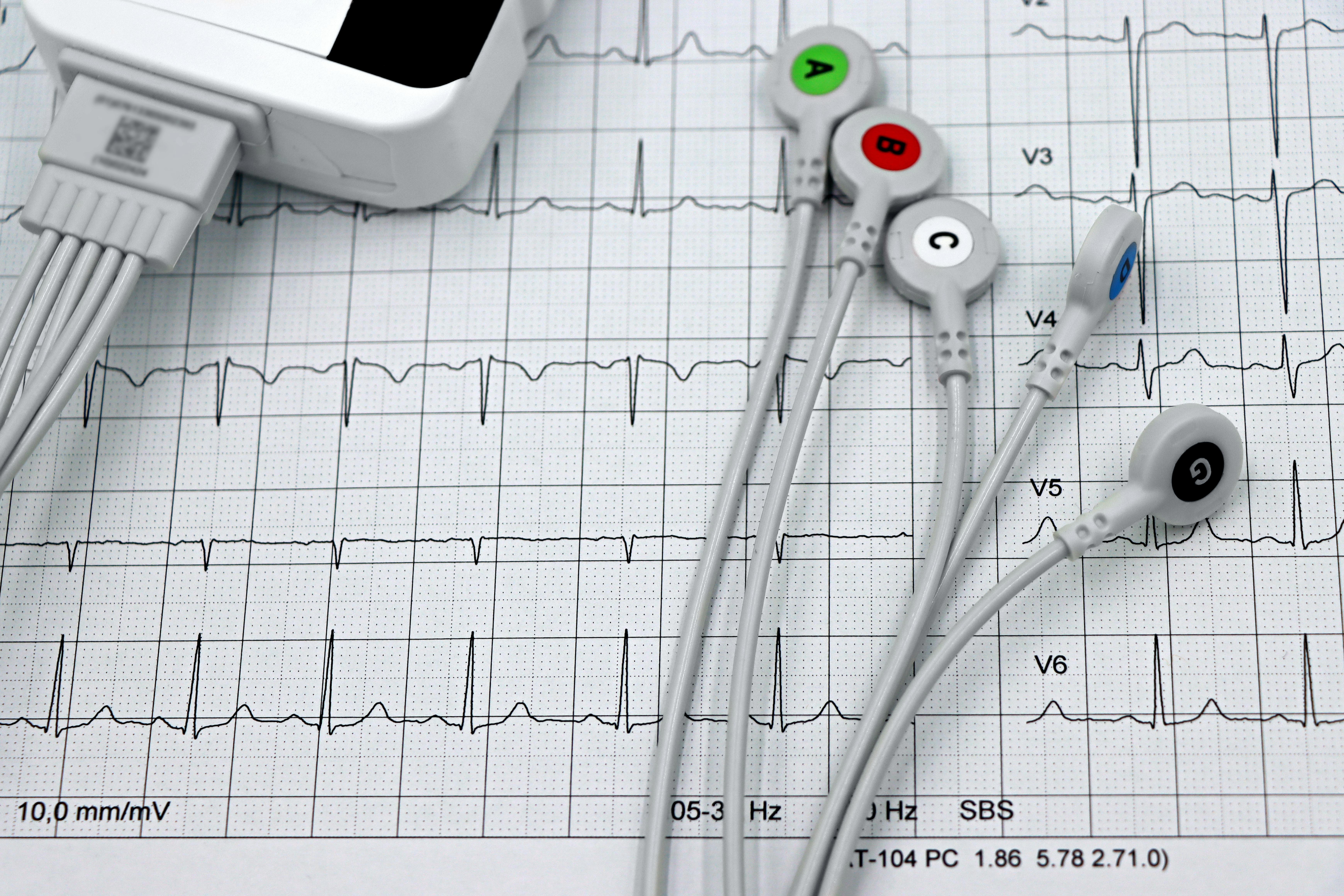 ECG Opleiding