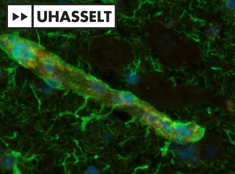 Aging Screen Microscopiefoto Celveroudering