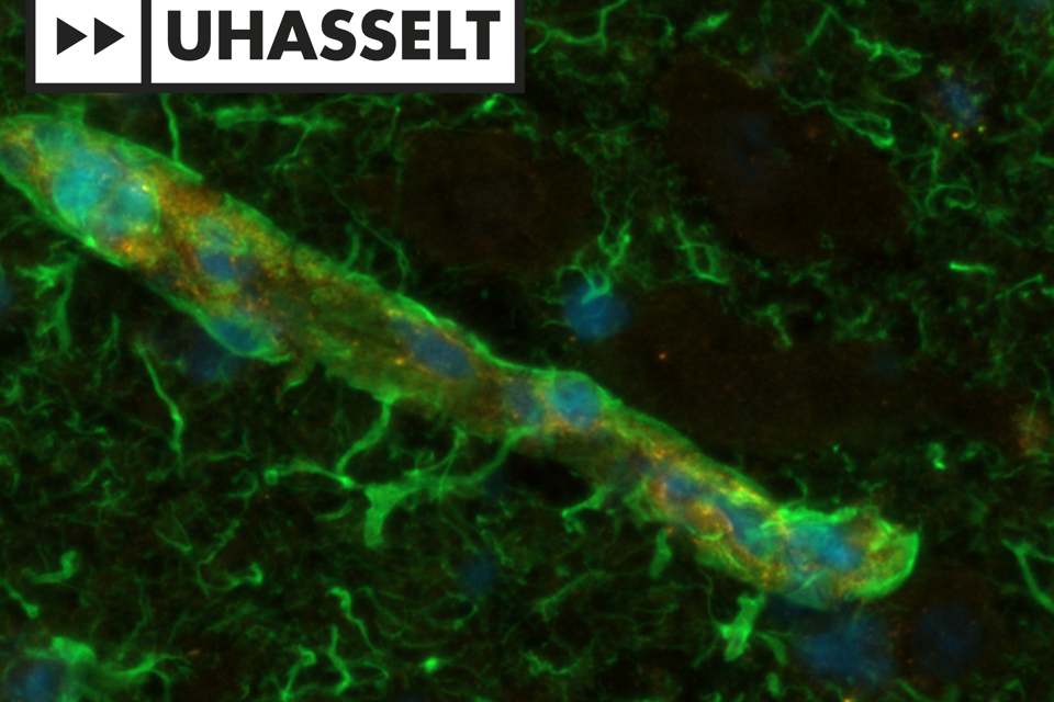 Aging Screen Microscopiefoto Celveroudering