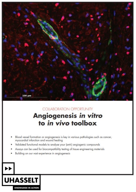 Angiogenesis in vitro to in vivo toolbox
