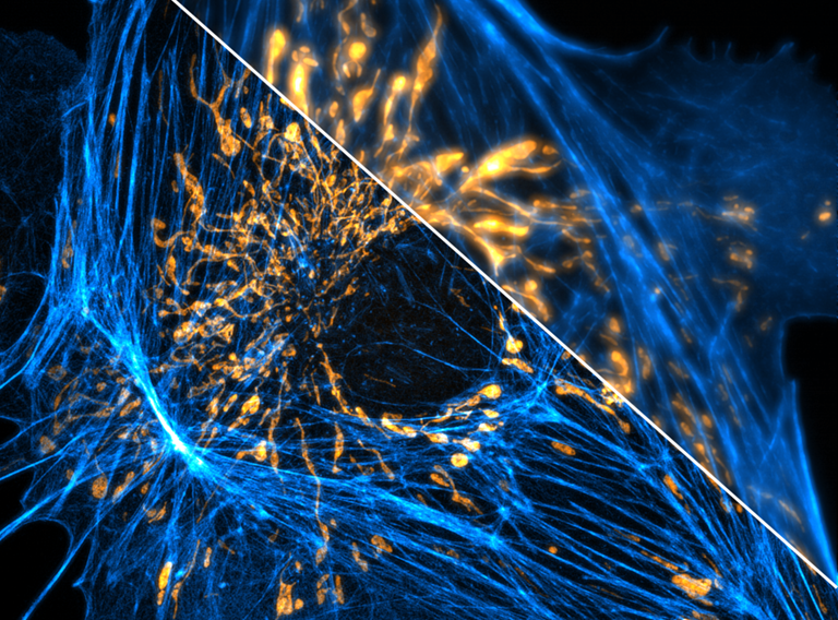 Dual color fluorescence micrograph displaying F-actin stained with Alexa Fluor 488 phalloidin in blue and mitochondria stained with MitoTracker Red CMXRos in Orange. The bottom left portion of the image shows a reconstructed structured illumination image, while the top right part of the image shows the conventional EPI fluorescence image.