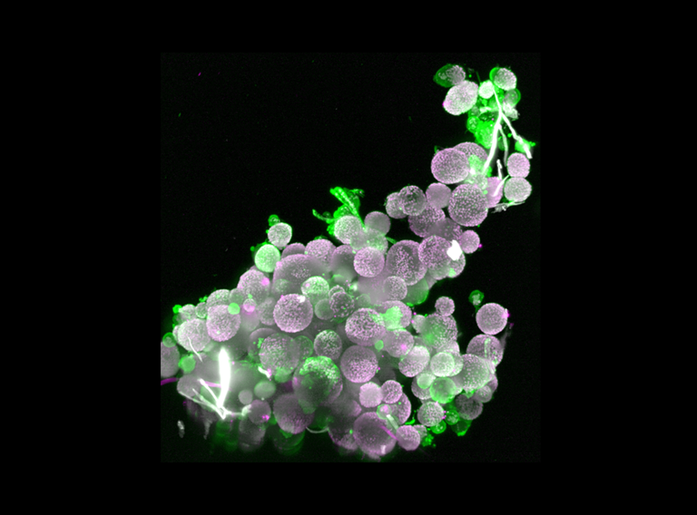 Lightsheet microscopy image of organoids.