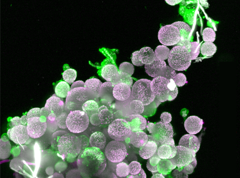 Lightsheet microscopy image of organoids.