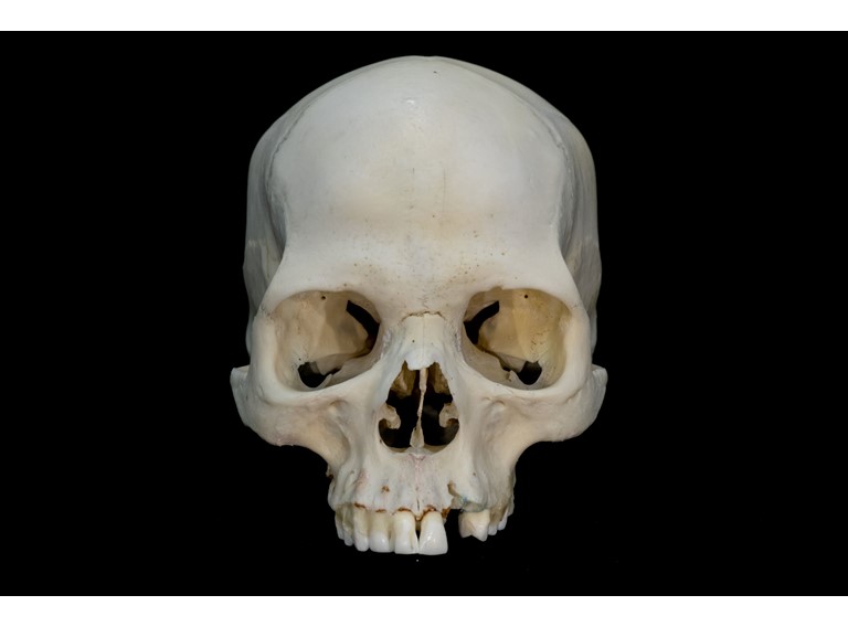 Osteologiemateriaal Schedel 17